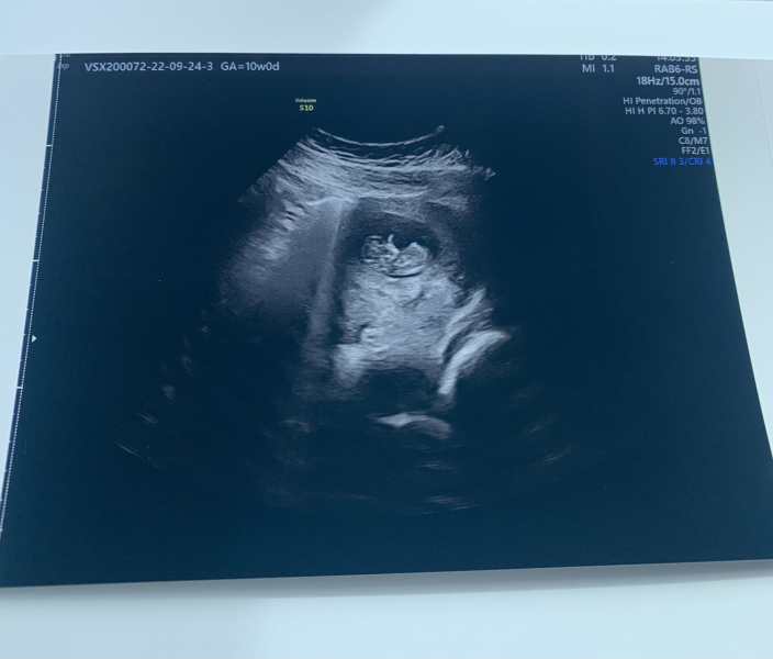 IVFers Due Mar & Apr 2023