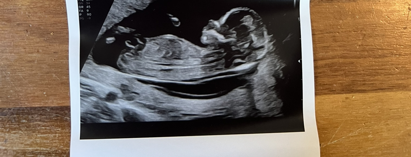 Babies Due April 2023 thread 5