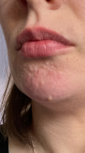 My face. What can I do about this?