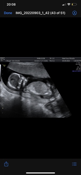 Girl or boy?
