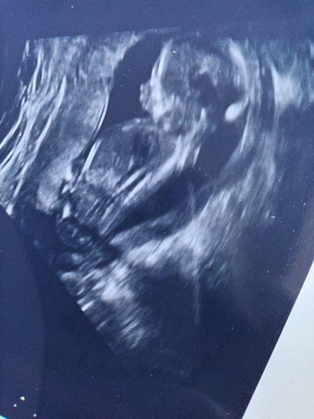 Due March 2023 - thread 3