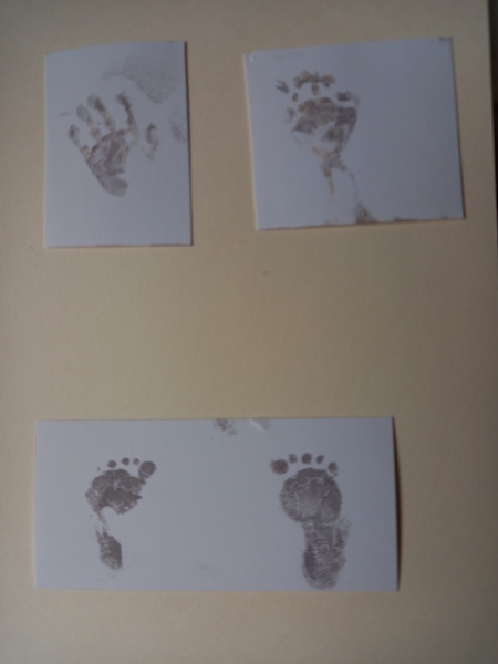 Trying to cope with late miscarriage at 18 weeks😪 