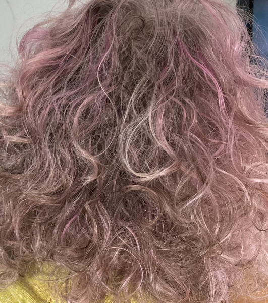 Dark hair going grey. 