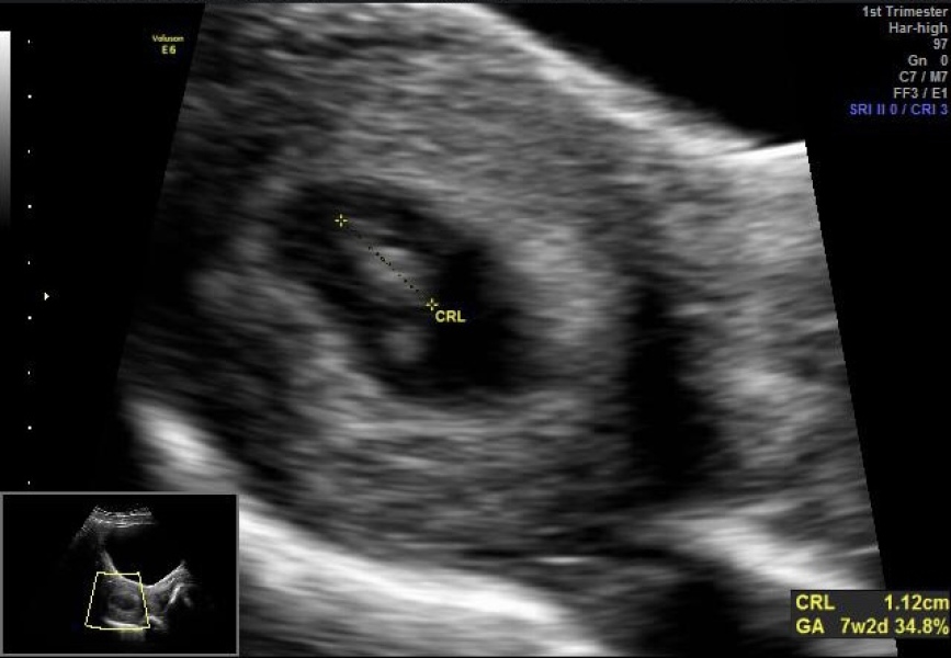 Babies Due April 2023 Thread 4 