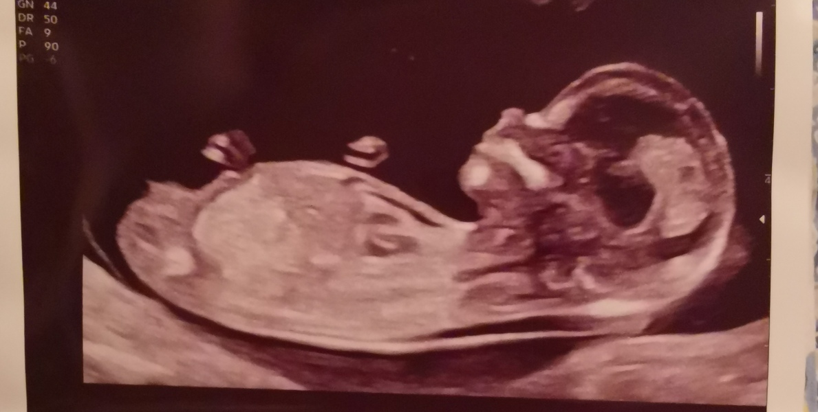 Gender guesses