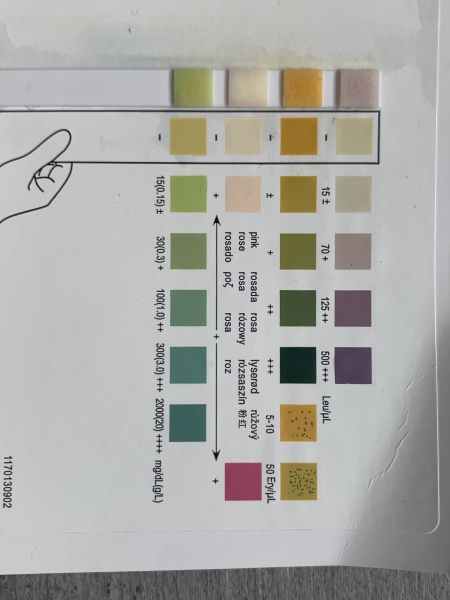 Dip test results 