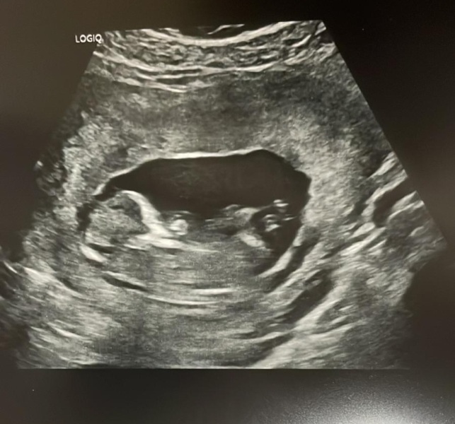 IVFers Due Mar & Apr 2023