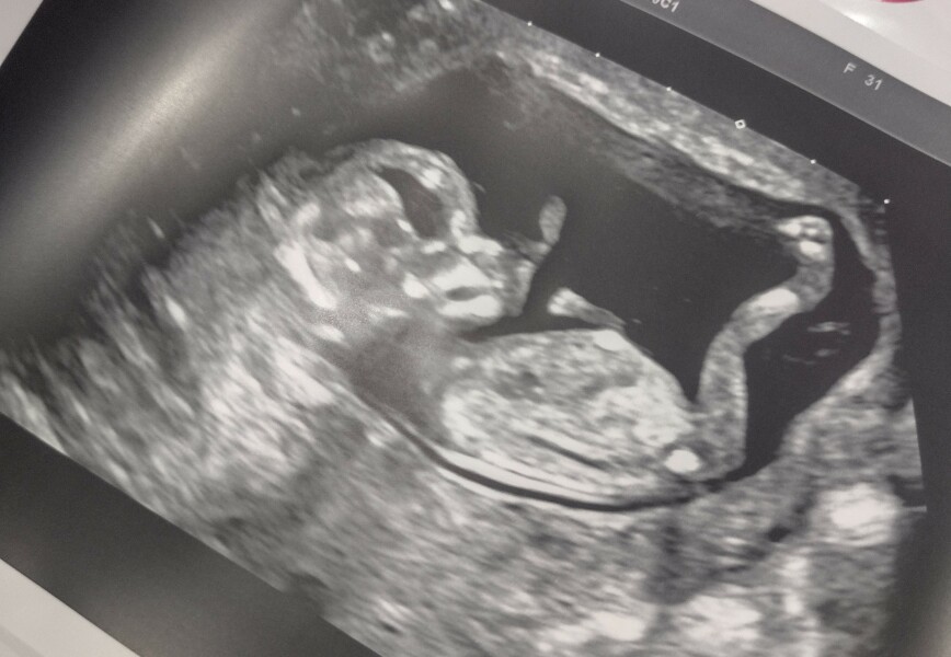 Due March 2023 - thread 3