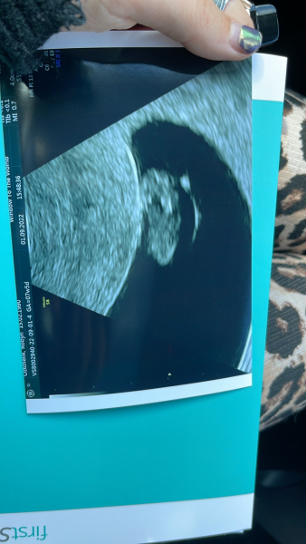 Babies Due April 2023 Thread 4 