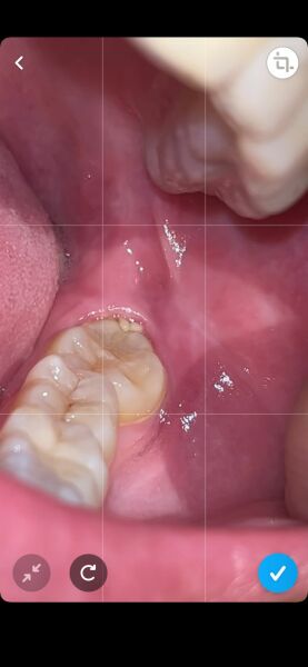 Any dentist or dental nurses?