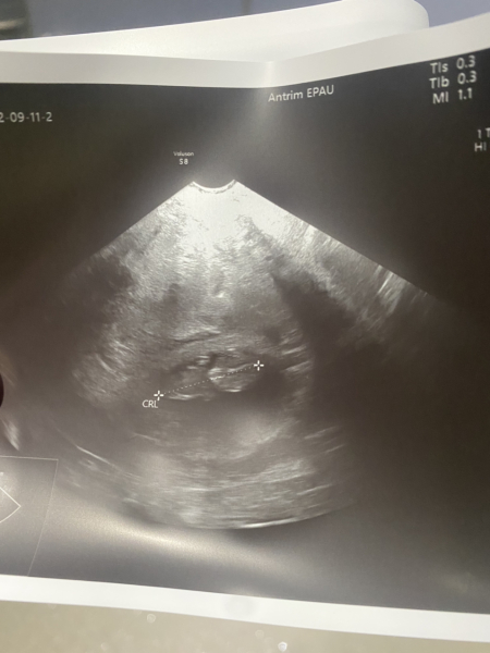 Babies Due April 2023 Thread 4 
