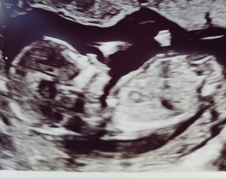 Gender guess from a scan photo - how?