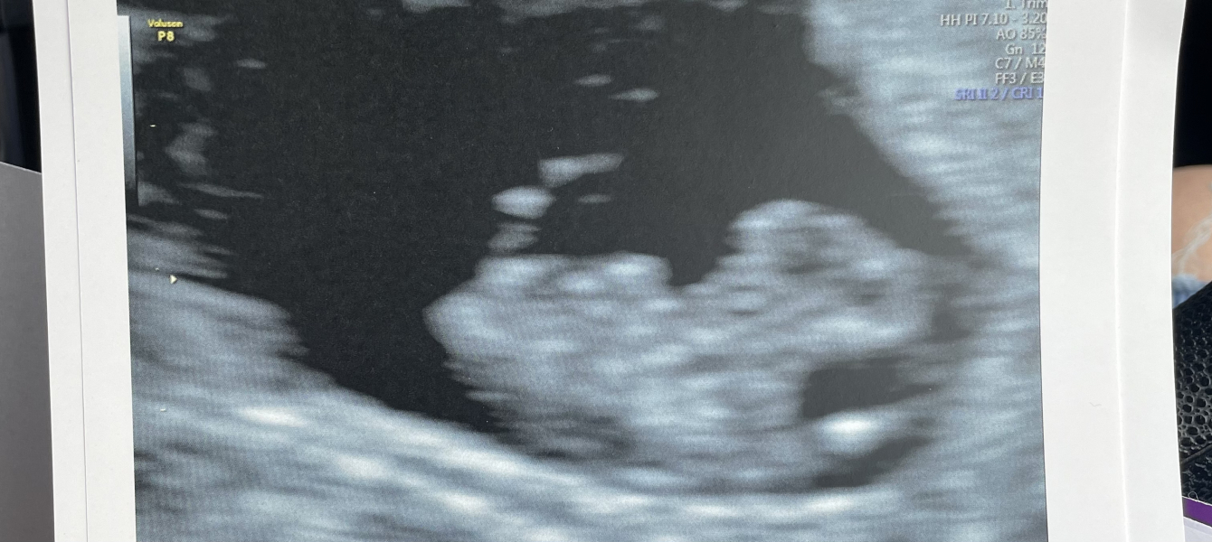 Babies Due April 2023 Thread 4 
