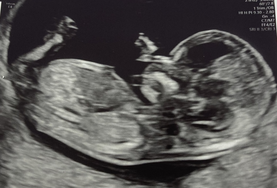 Gender predictions?