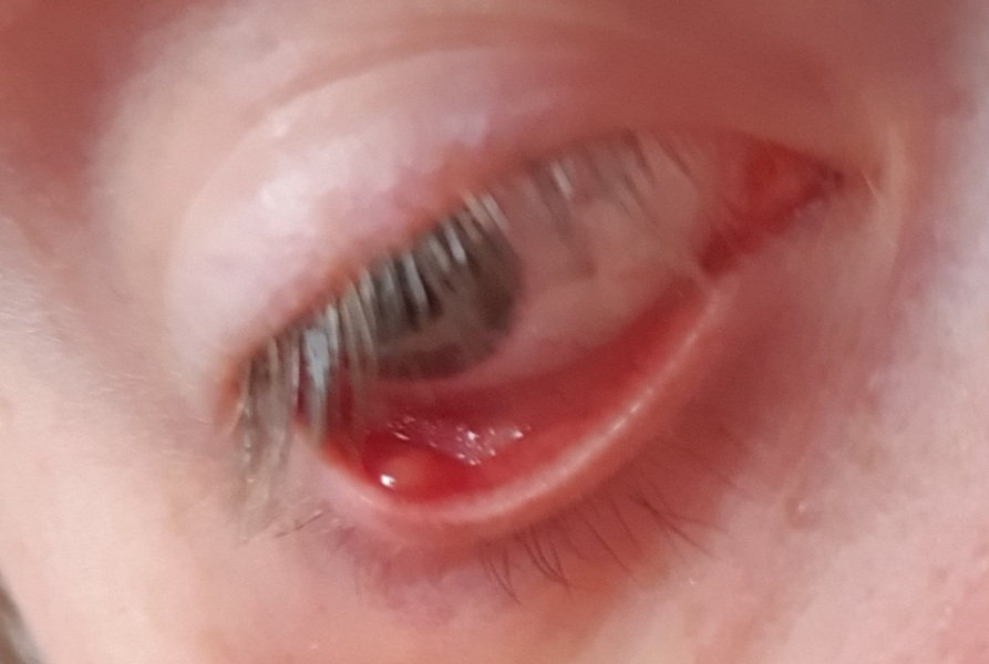 WTH is this in my eye? Picture attached 