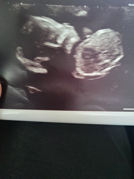 Boy or Girl