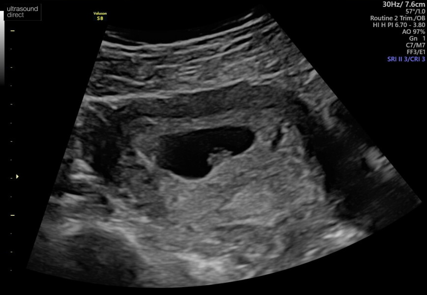 Babies Due April 2023 Thread 4 
