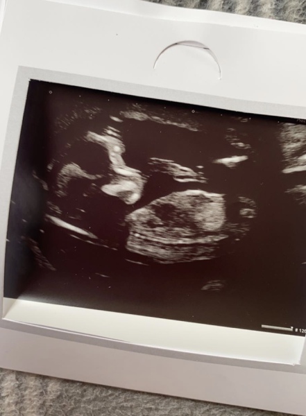 14wks Gender guesses!
