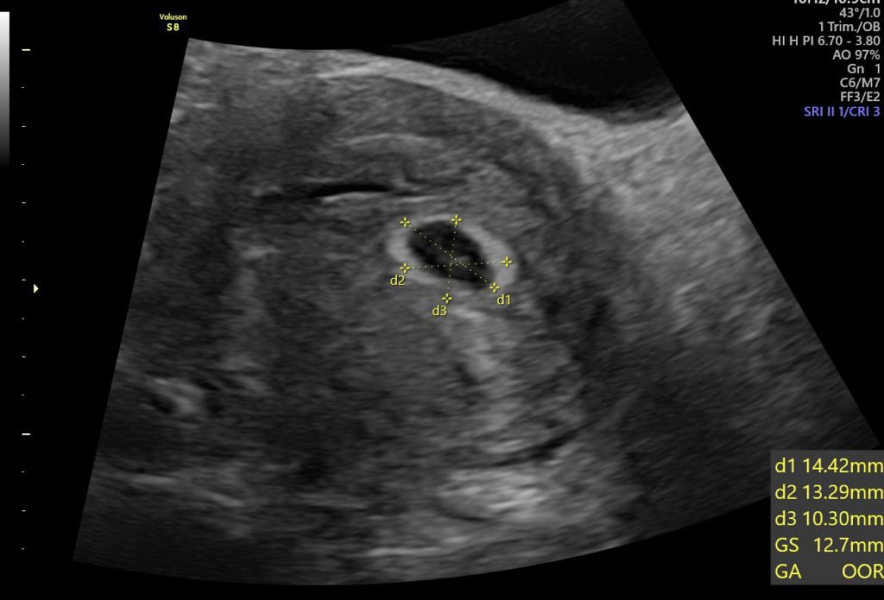 Babies Due April 2023 Thread 4 