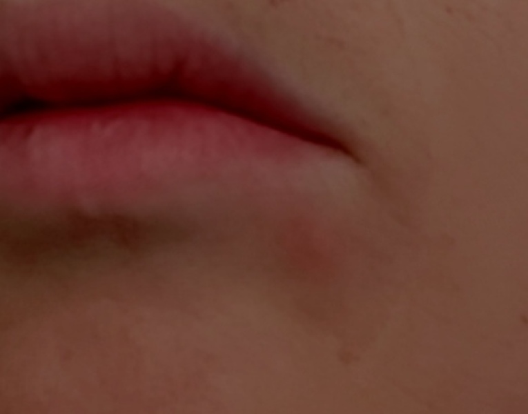 Is it a cold sore 