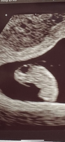 Babies Due April 2023 thread 5