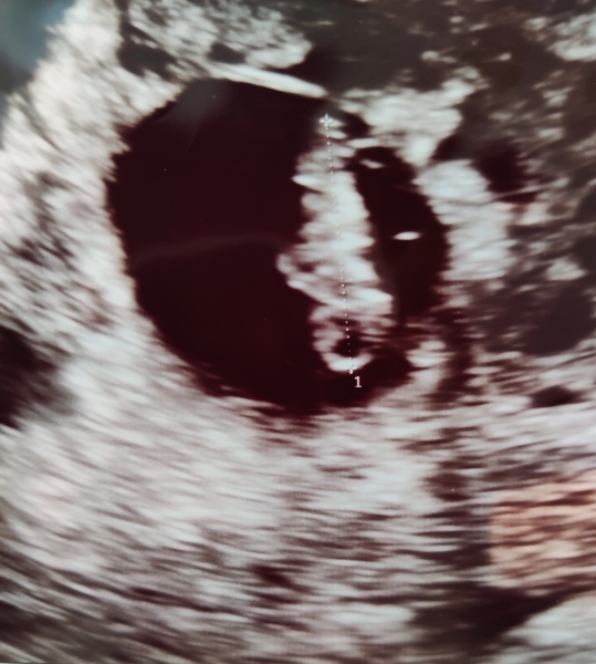 Babies Due April 2023 Thread 4 
