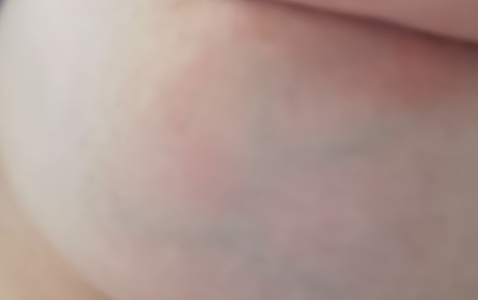 Extremely painful to breastfeed on one side