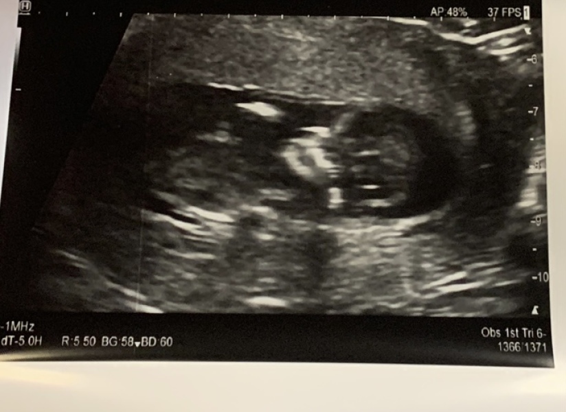 Due March 2023 - thread 3