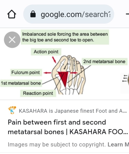 Not sure what to call this! Foot pain.