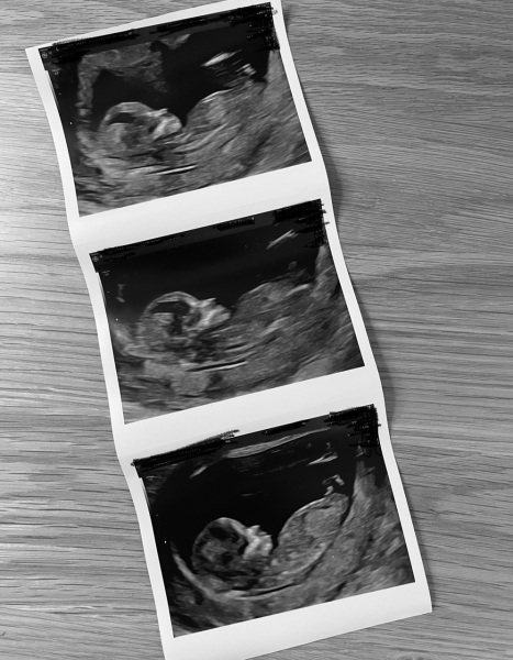 Girl or Boy? Gender predictions!