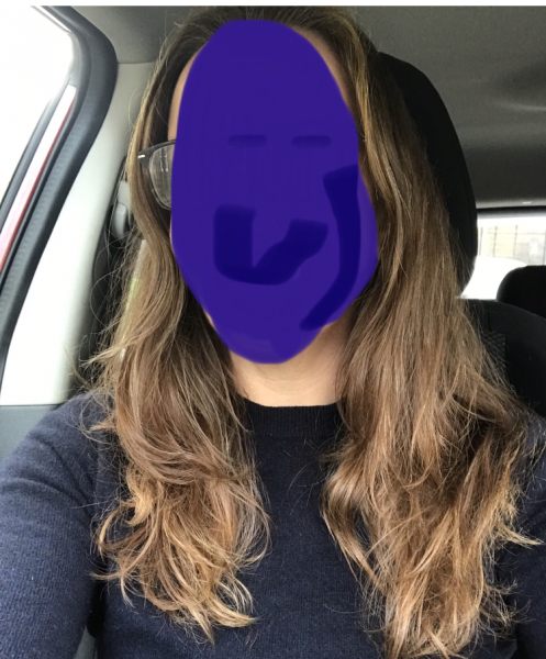 Dark hair going grey. 