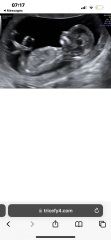 Gender Scan
