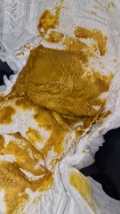 Breastfed baby poop??