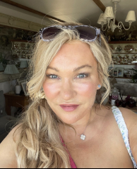 I had a neck and lower facelift 48 hours ago