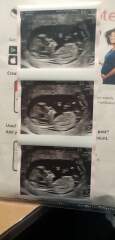 12 week scan - baby gender guesses ??