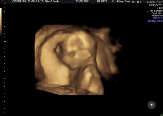 IVFers Due Mar & Apr 2023