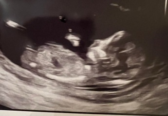 Nub Guesses - confused need fresh eyes!