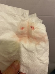 Is this a 'bloody show' shoddy for the pics !