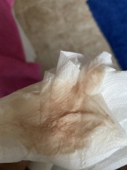 Implantation bleeding