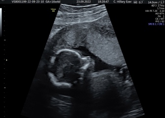 IVFers Due Mar & Apr 2023
