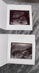 Girl or boy?