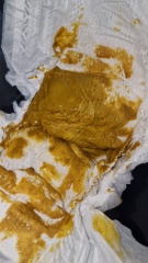 Breastfed baby poop??