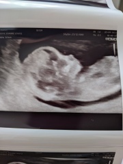 Guess baby’s gender from gender scan pic! 😍
