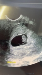 Babies Due April 2023 Thread 4 