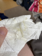 Possible cervical erosion/ectroption?! Please help!