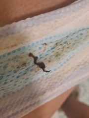 6 weeks strange discharge help!!
