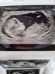 Guess baby’s gender from gender scan pic! 😍