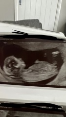 13 weeks nub theory boy/girl 