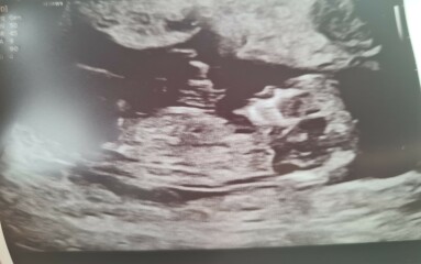 Due March 2023 - thread 3