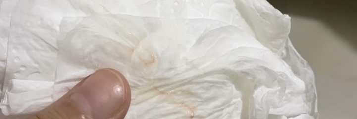 Is this implantation bleeding? 